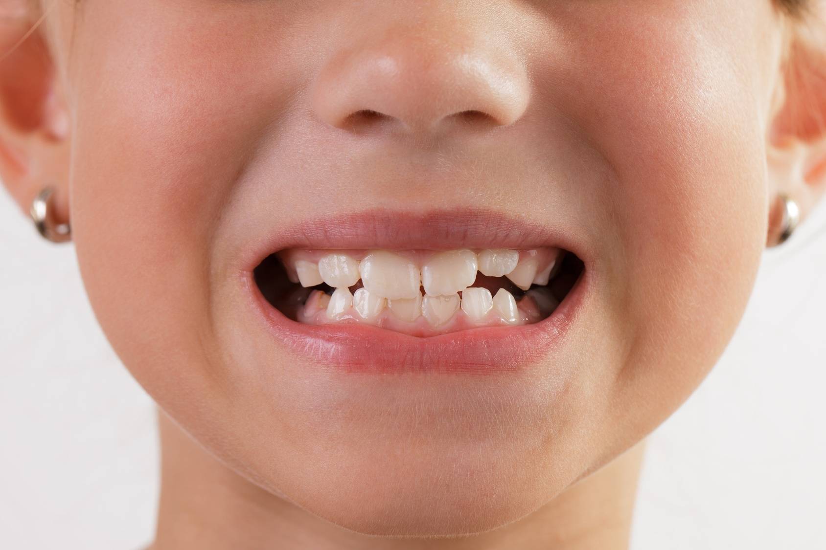 коренной зуб у ребенка