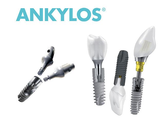 система имплантов Ankylos 