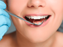 отбеливание зубов, безопасное отбеливание зубов 