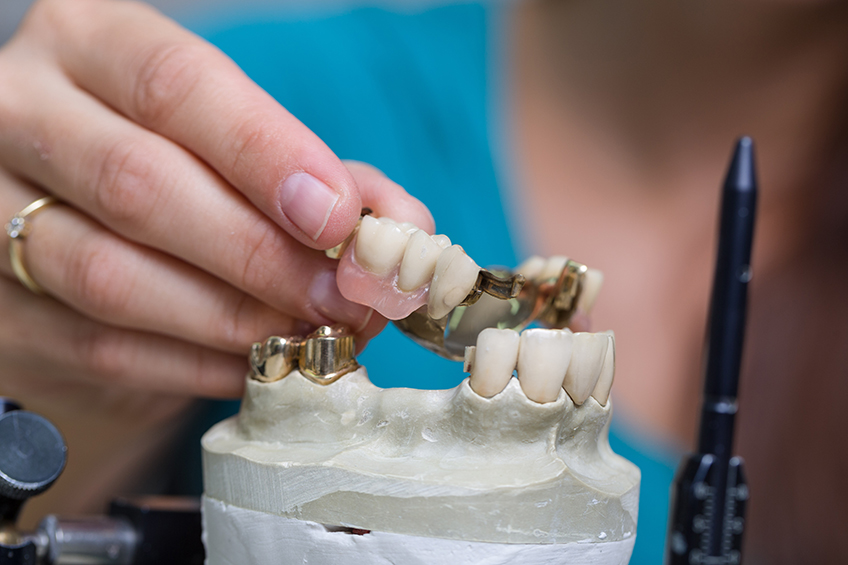 протезирование зубов, вставить зубы